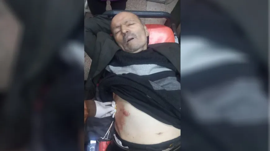 إصابة مدني آخر جراء قصف مرتزقة الحكومة المؤقتة على حي الشيخ مقصود في حلب