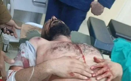 محاولة اغتيال تطال قائد كتيبة في الفرقة 62 بحماة 