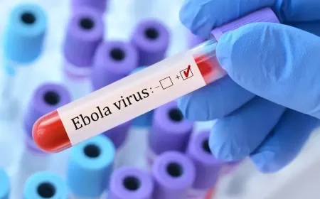 رفع مستوى خطر تفشي إيبولا في الكونغو من مرتفع إلى مرتفع جداً