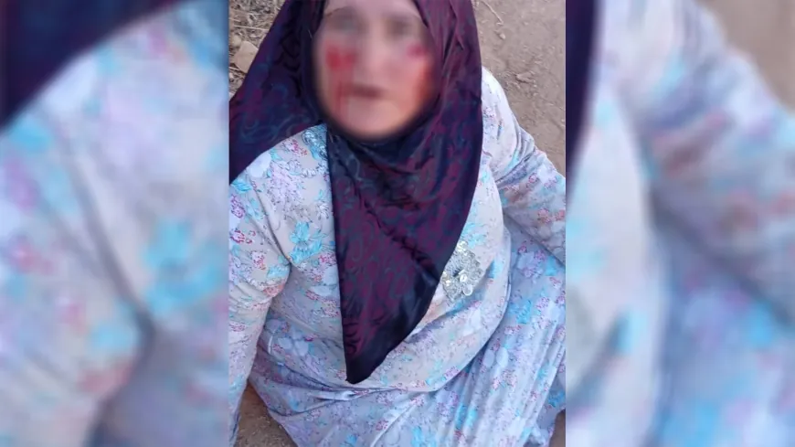 إصابة مواطنة كردية في تل عران إثر الاعتداء عليها