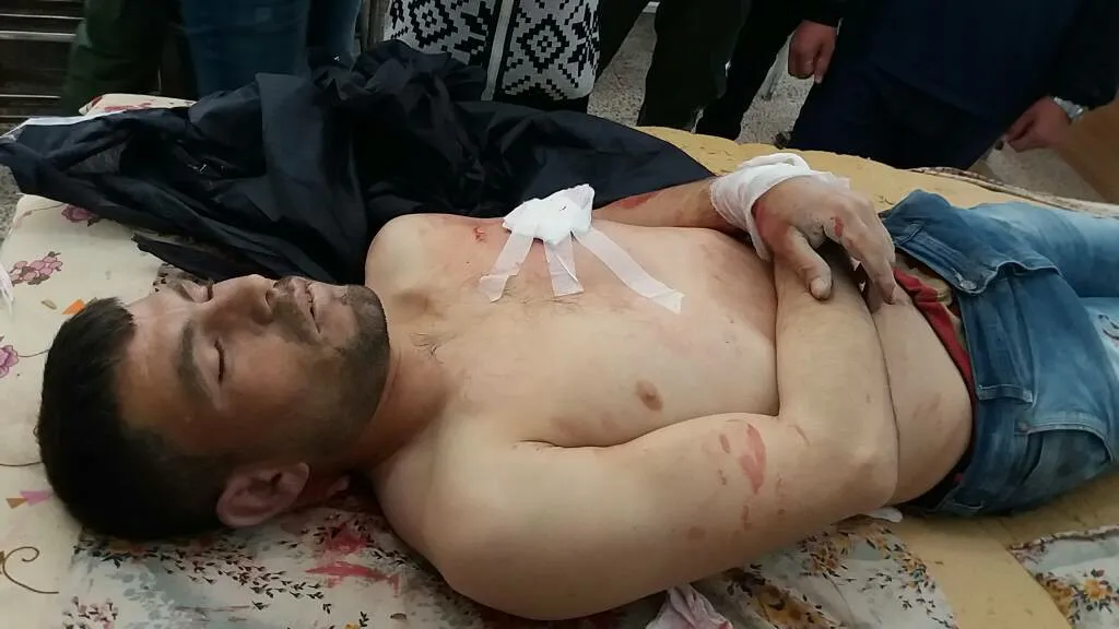 Civilian martyred, child wounded by Turkish occupation army bullet on border