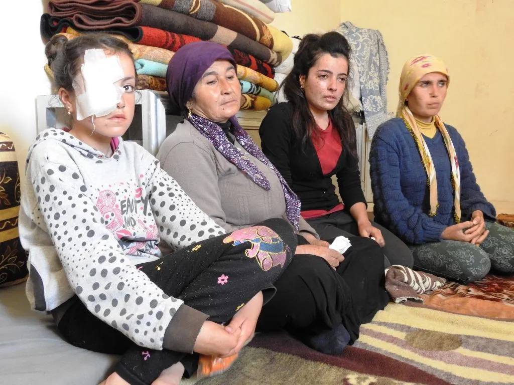 Three sisters lost each one of their eyes need treatment