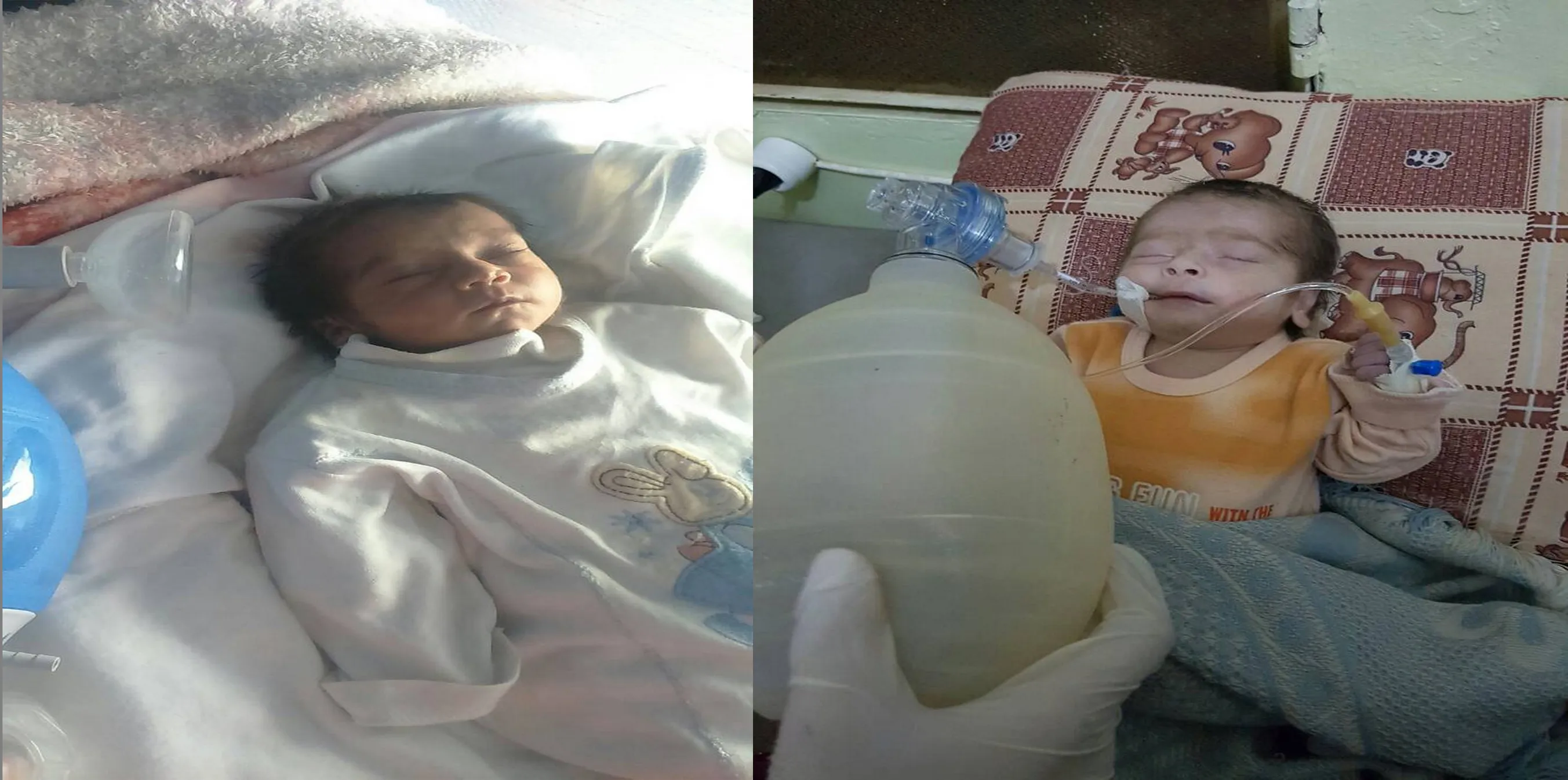 Lack of medical equipments in al-Shahba camps caused died 2 babies