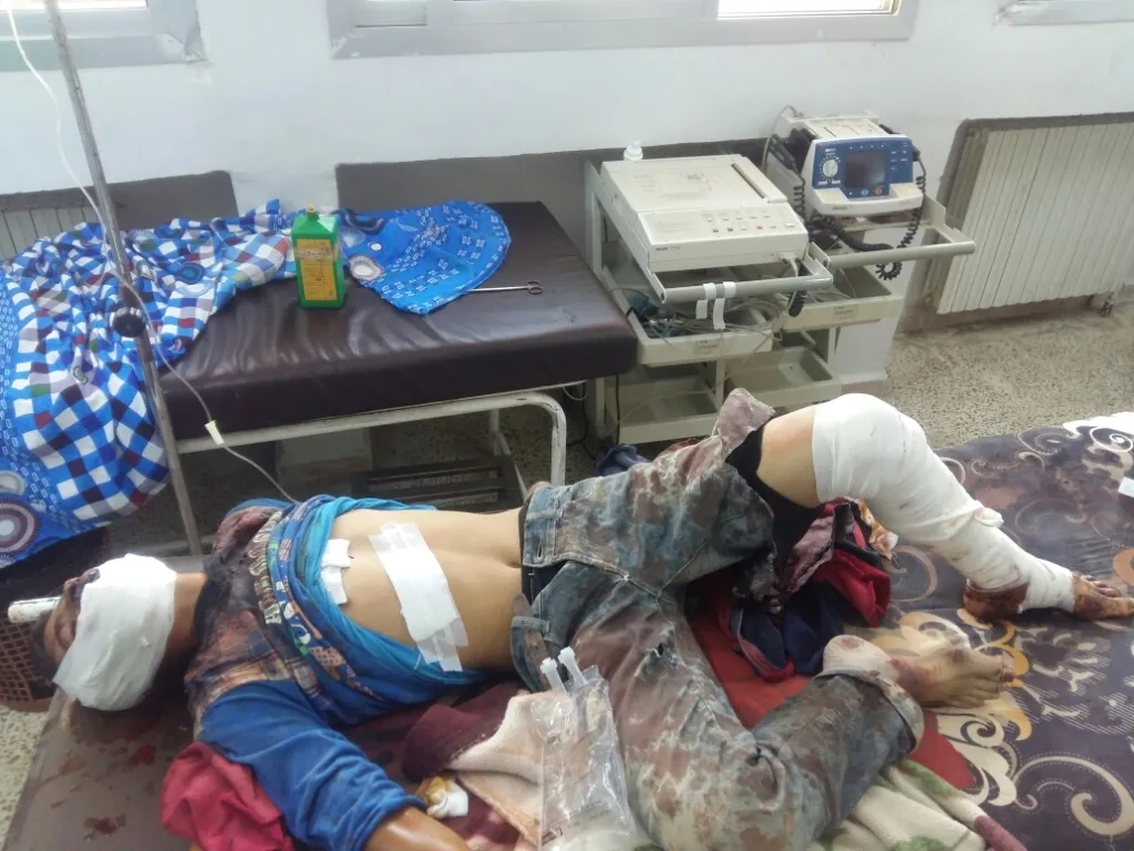 Child injured in mine accident in Kazwan Mount area