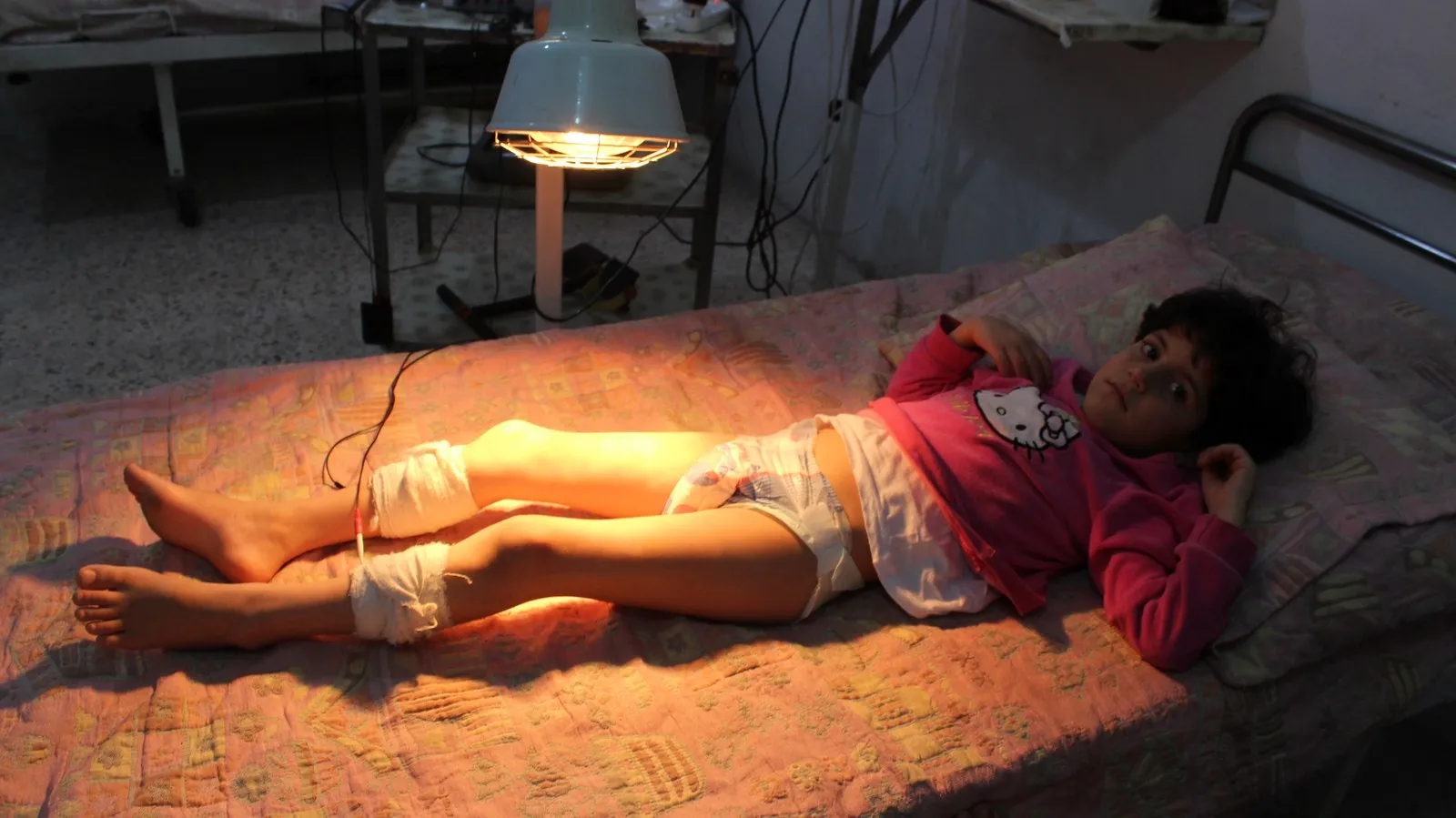 Shrapnel of Turkish occupation missiles paralyze her after it killed her sister