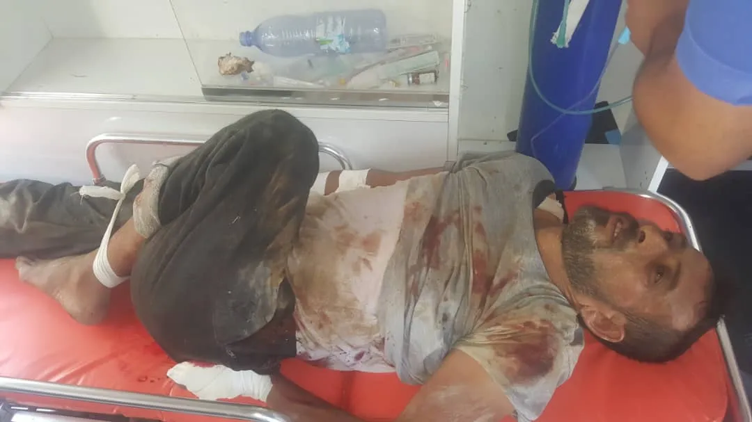Two citizen wounded in Serê Kaniyê by Turkish occupation's shelling