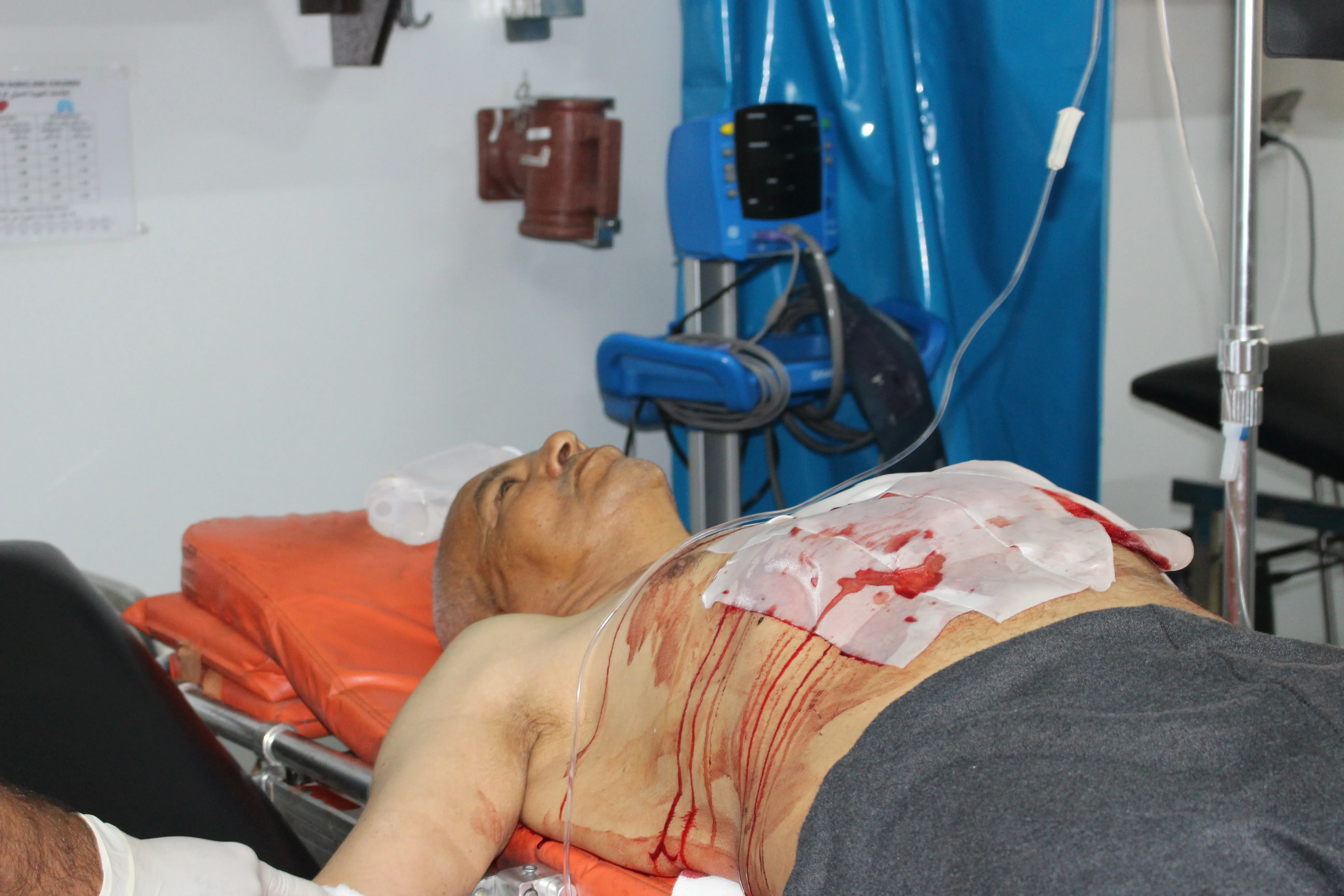 Al-Shadadi’s wounded in stable condition