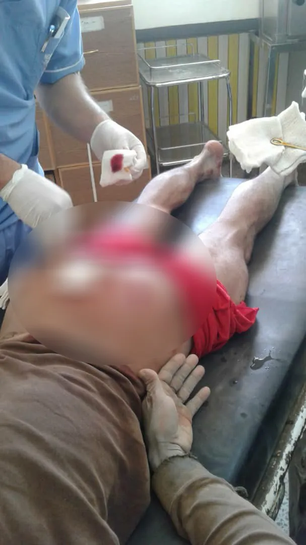 One civilian injured in Serê Kaniyê by Turkish occupation