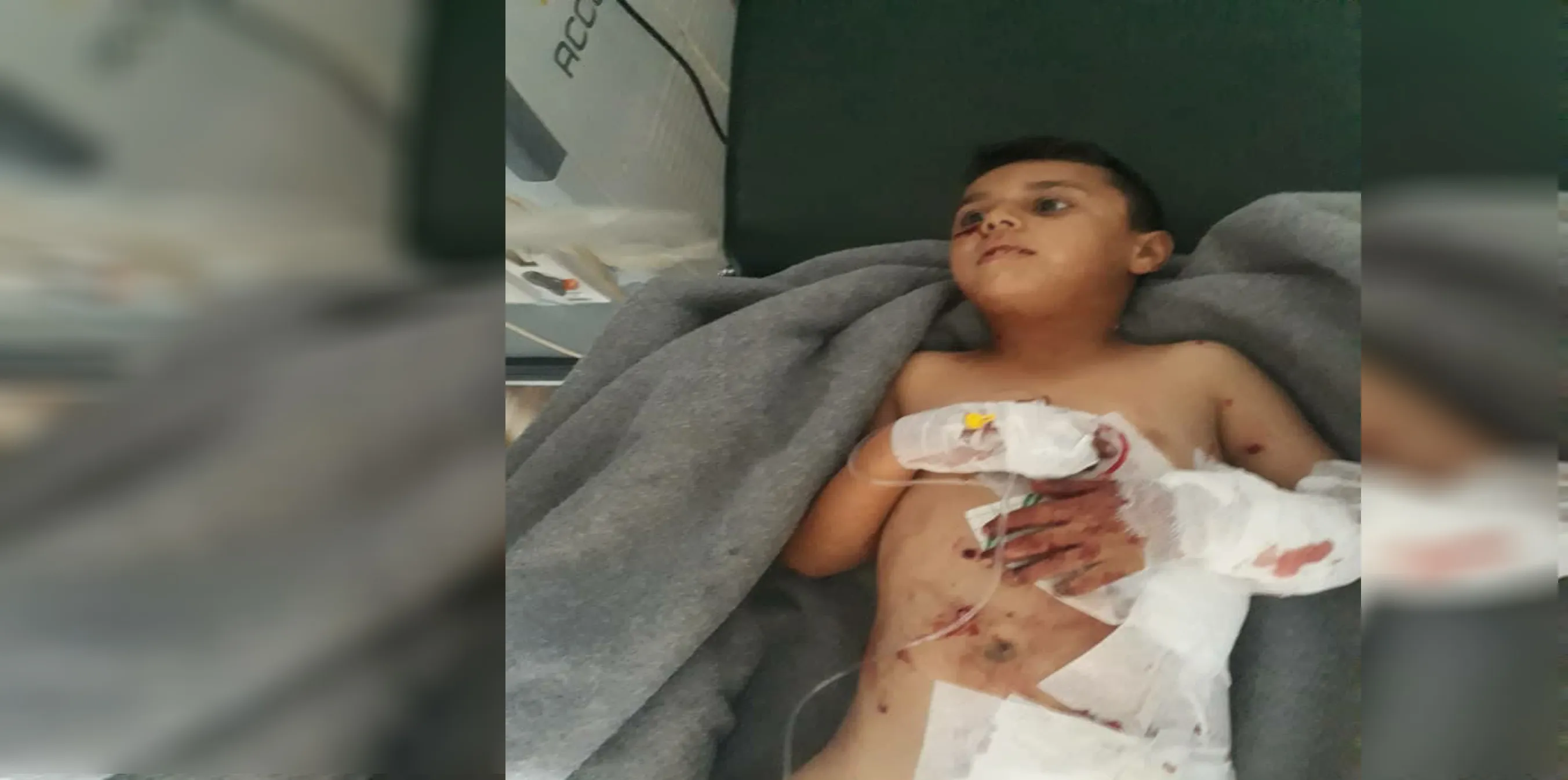 Cluster mine blasted, left 3 wounded in al-Shahba