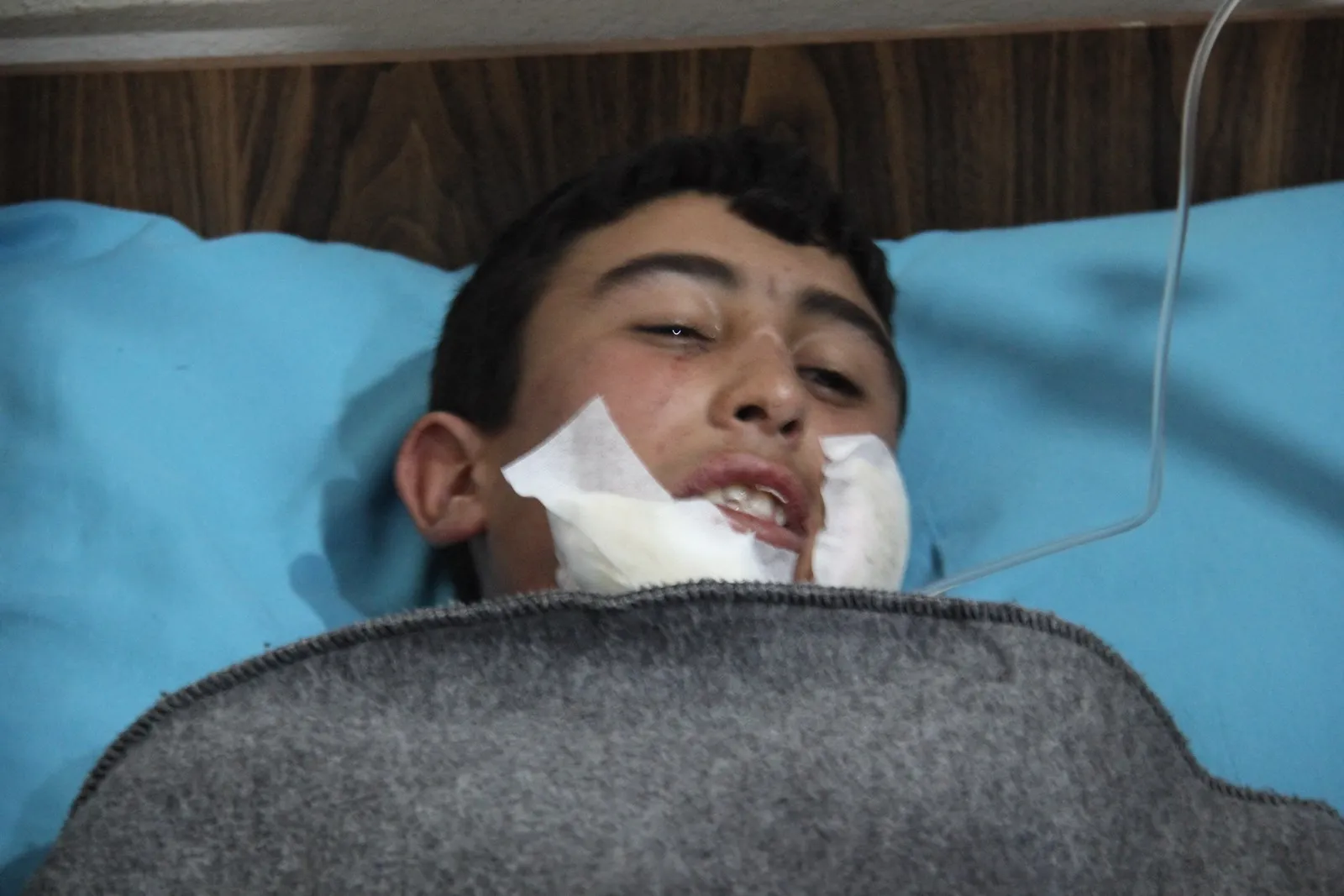 3 children injured by cluster bomb in al-Shahba