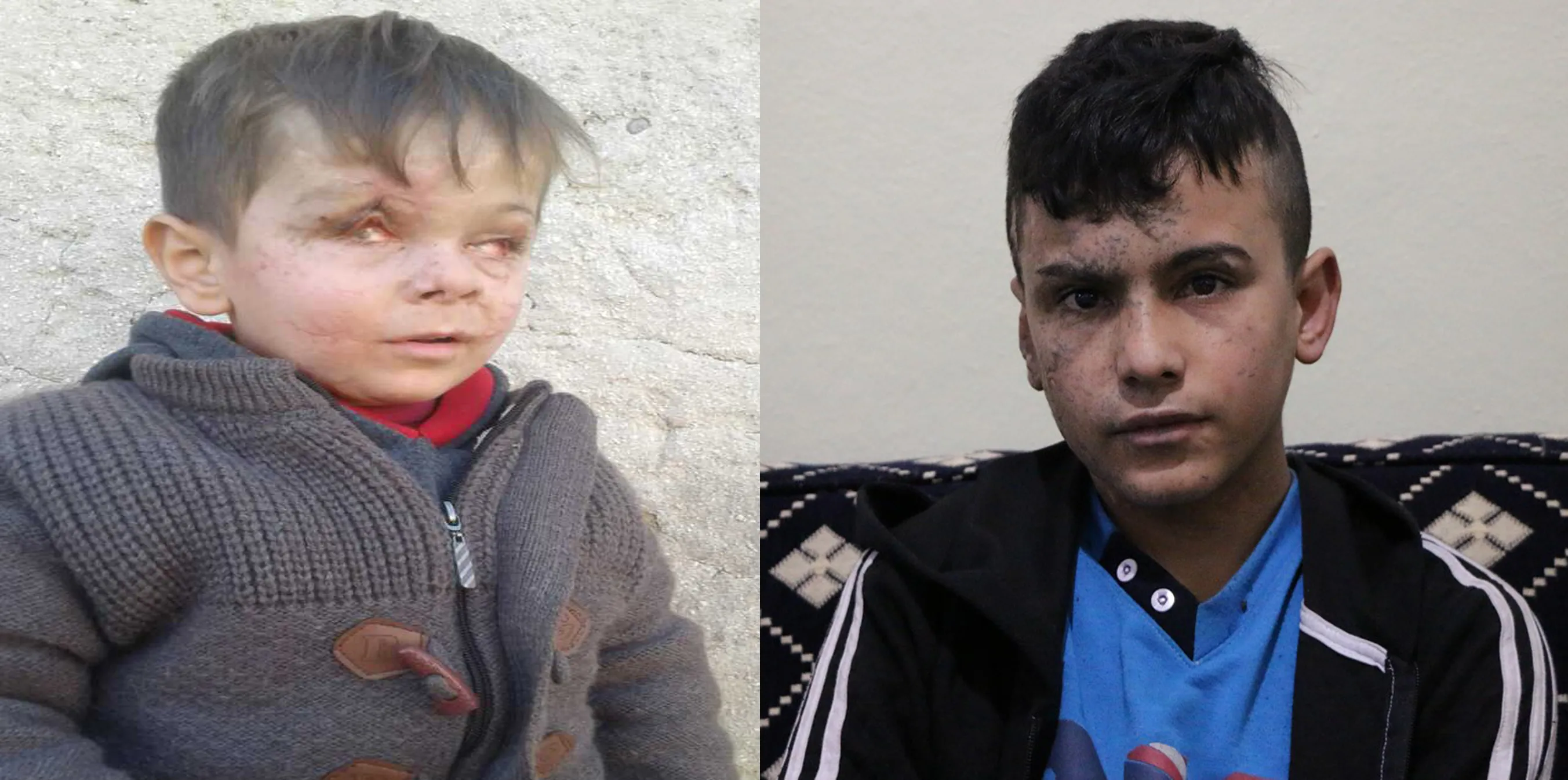 Mohammed, Jum'a lost sight due to Turkish bombardment