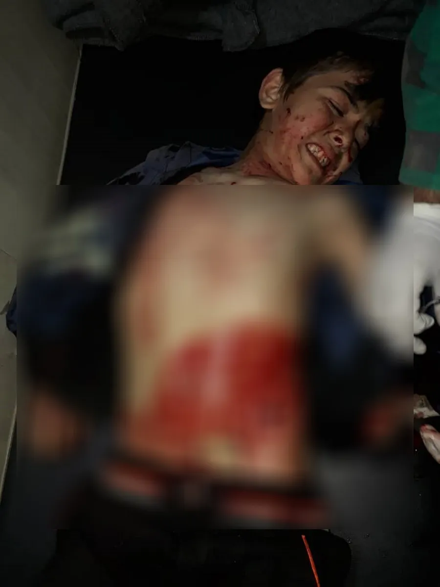 Mine explosion in al-Shahba, 1 child injured