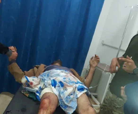 A woman lost life, 4 civilians wounded in a bombing in al-Tabqa