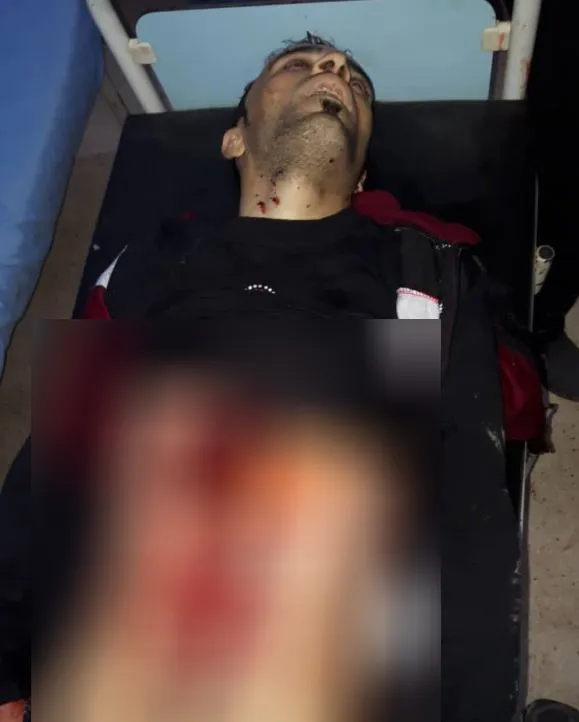 A woman lost life, 4 civilians wounded in a bombing in al-Tabqa