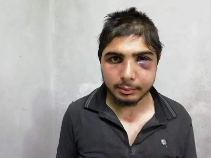 Turkish gendarmerie tortures 3 media activists supported by Turkey!