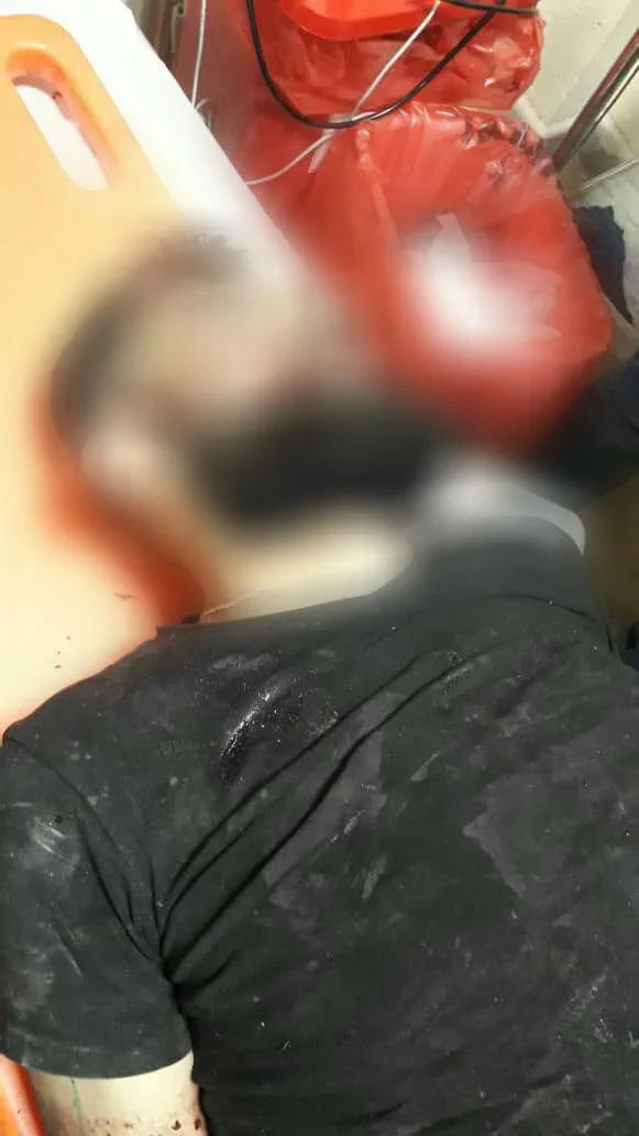 At least 7 people killed in clashes between Turkish mercenaries and Ajil clan