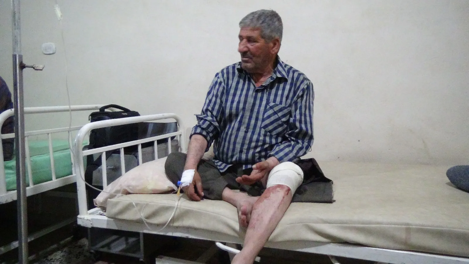 Turkish bombardment's wounded: We to continue our struggle till Afrin liberation