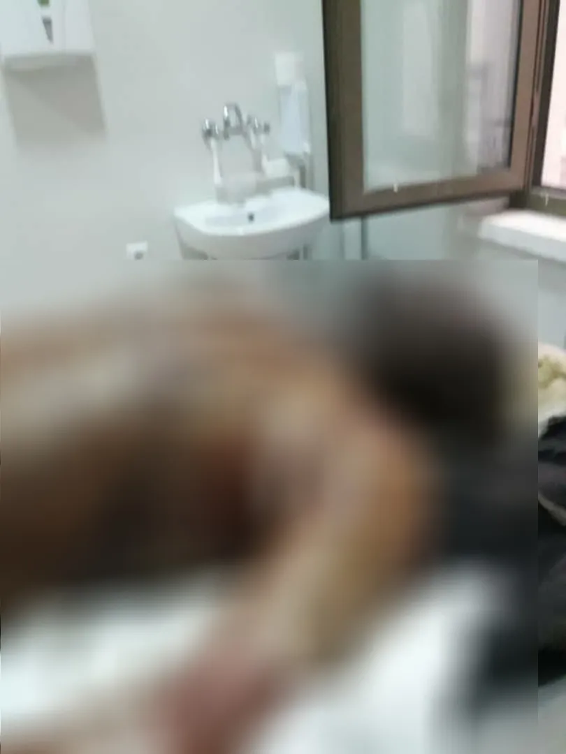Citizen got burnt in mysterious circumstances in Afrin