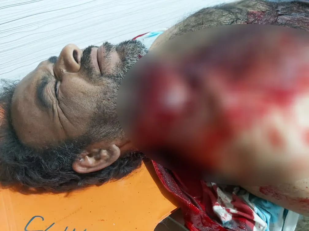 ISIS Women attempt to slaughter burying worker in al-Hol Camp