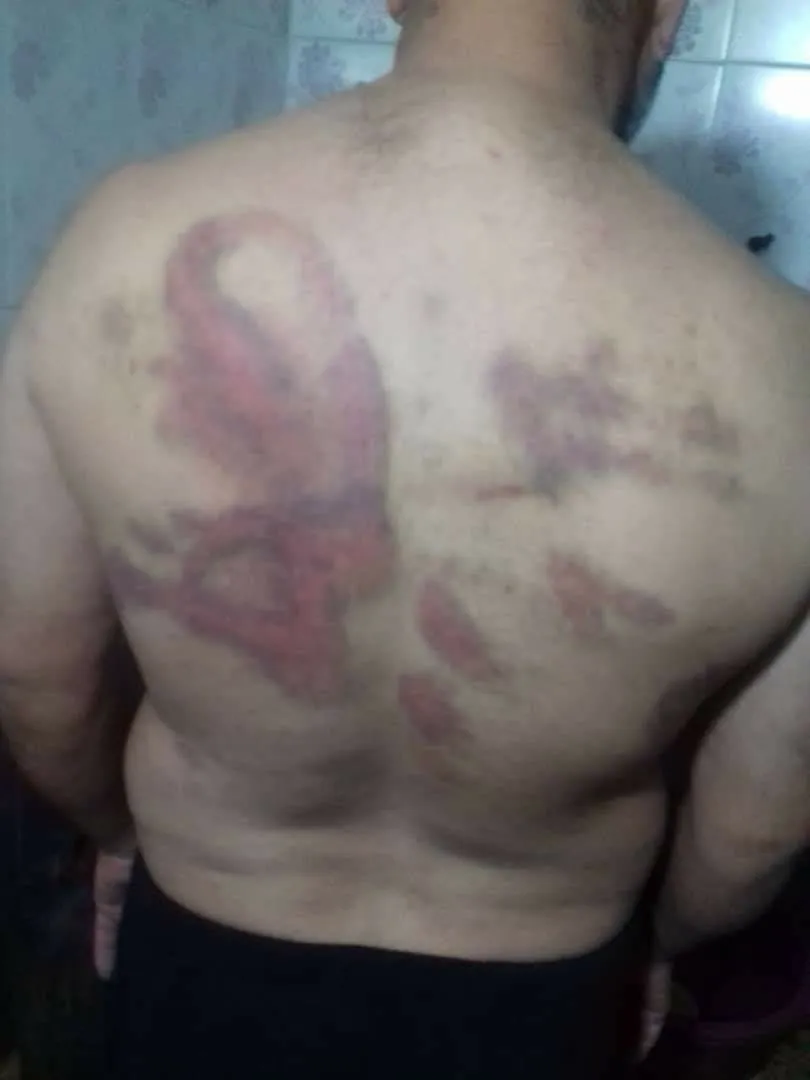 After being tortured for two days, they took a $ 4,000 ransom from his family