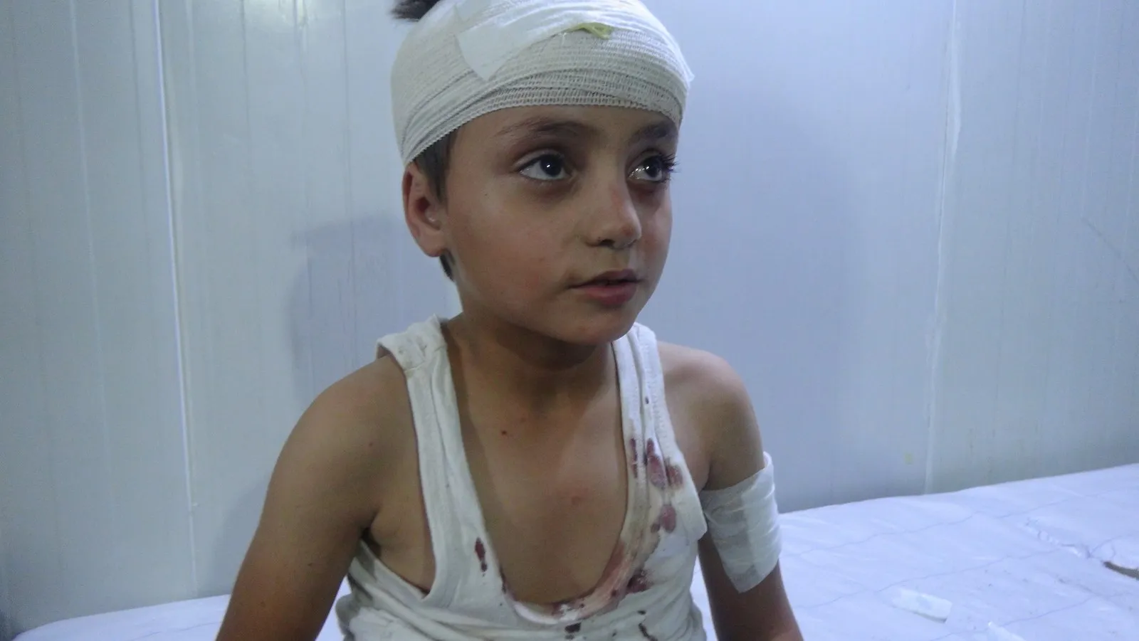 6 civilians, including 2 children, injured in Turkish shelling on Sheikh Issa village
