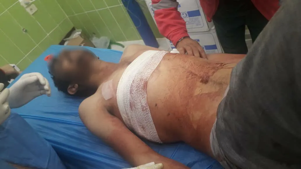Occupation army's attack left 12 wounded in the regime ranks