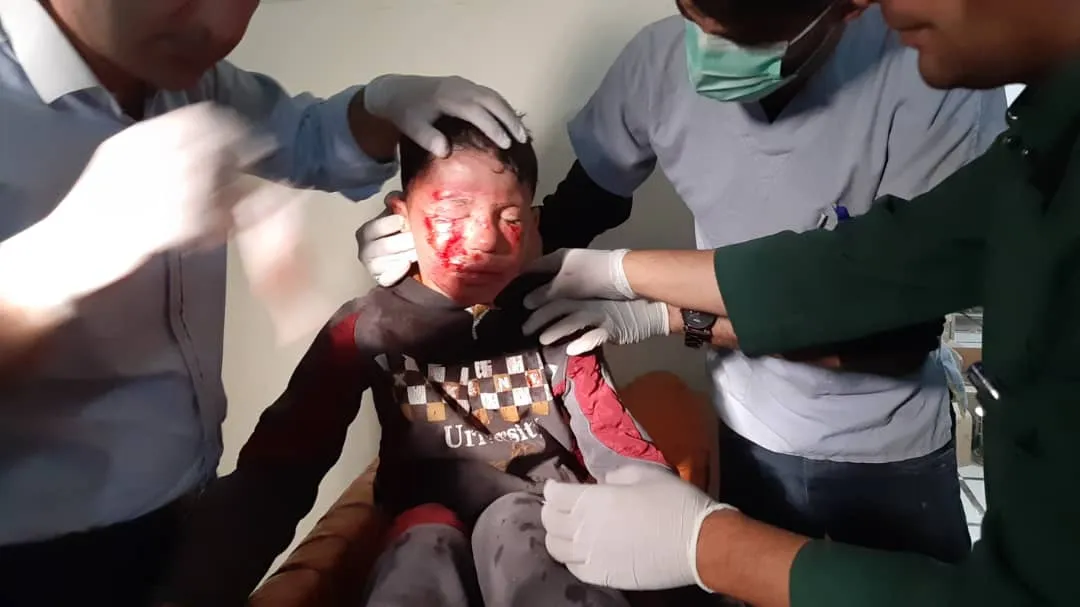 3,000 illness situation in Omar Alloush hospital due to Turkish occupation's attacks