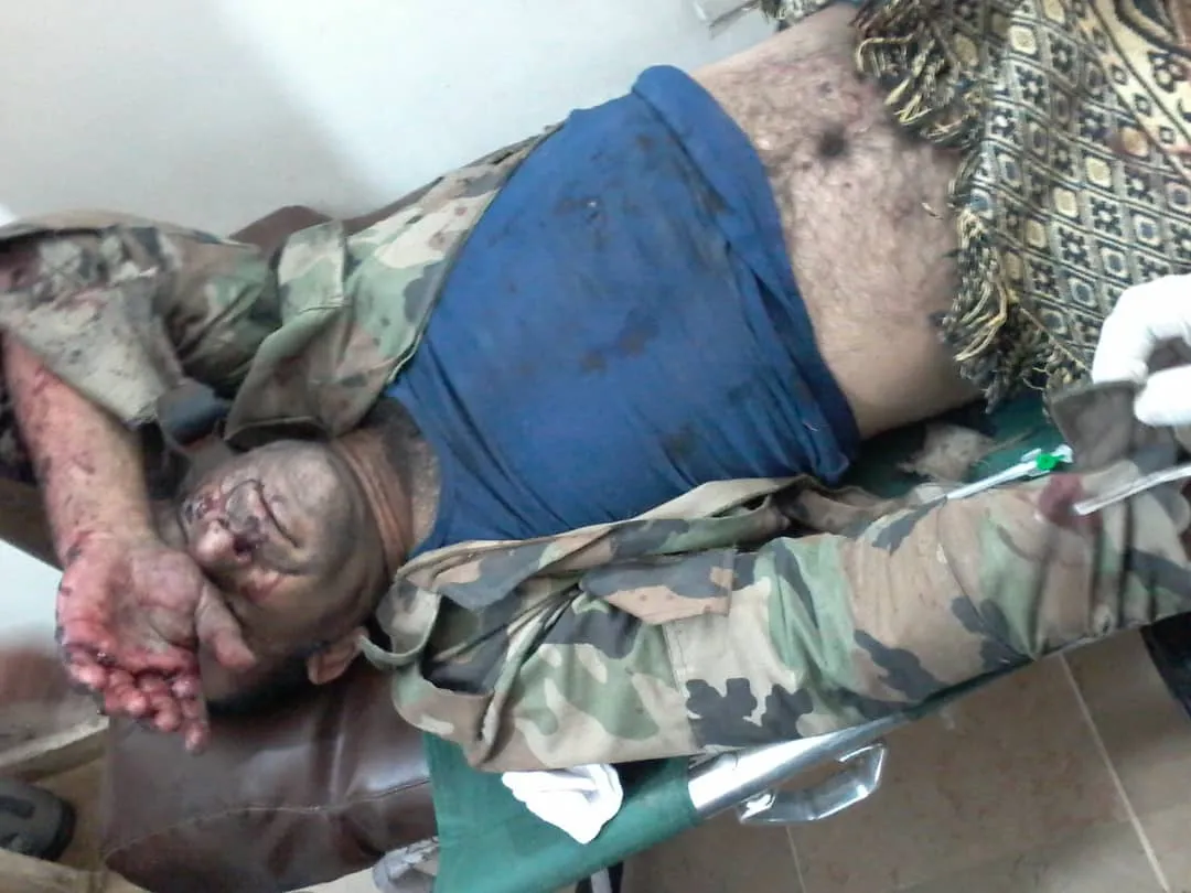 2 Regime forces' elements wounded by explosion landmine