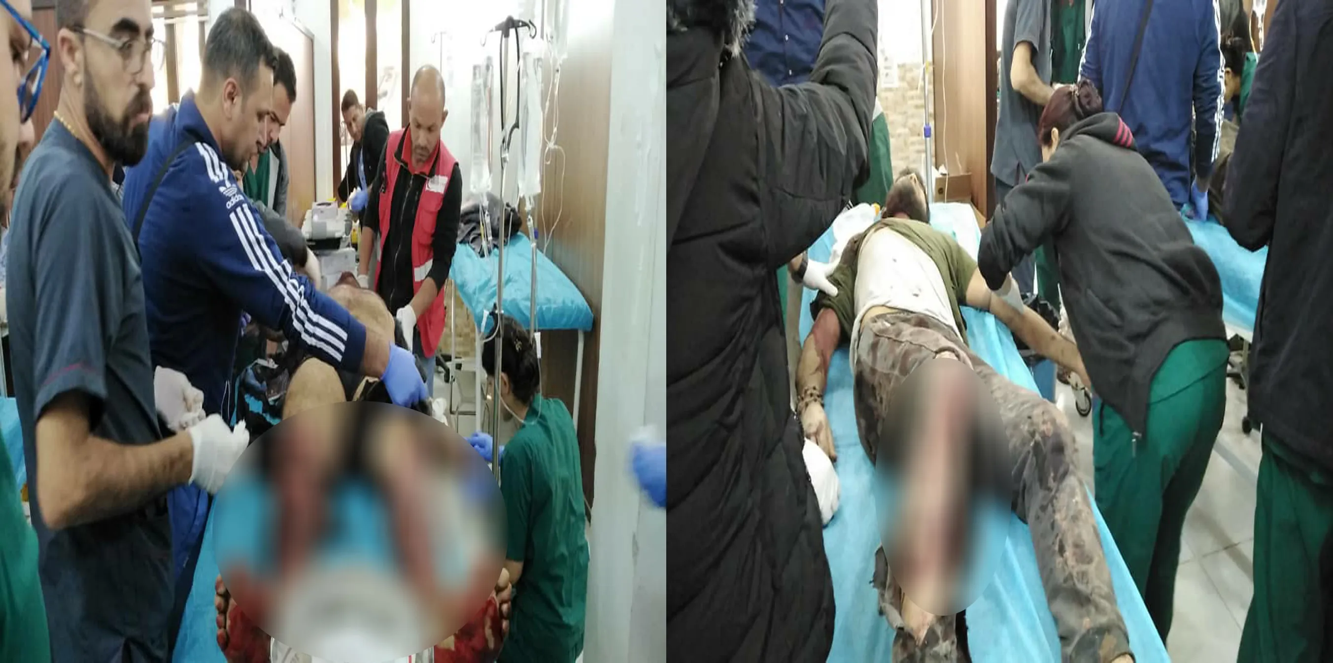 2 civilians wounded due to explosion landmine to Turkey's gangs