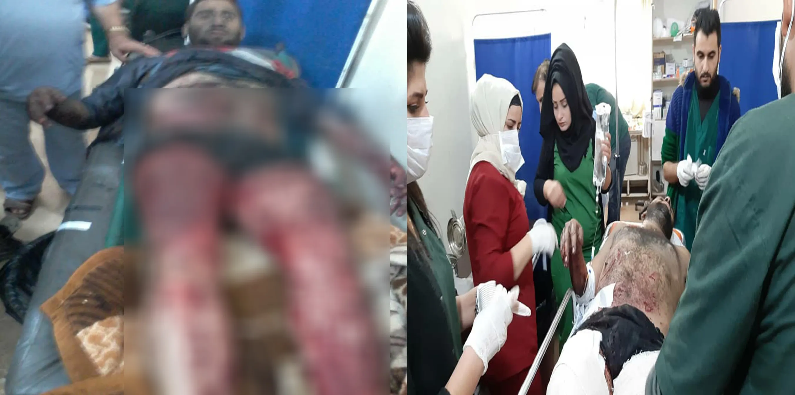 2 Regime's forces wounded due to explosion landmine in Zerkan