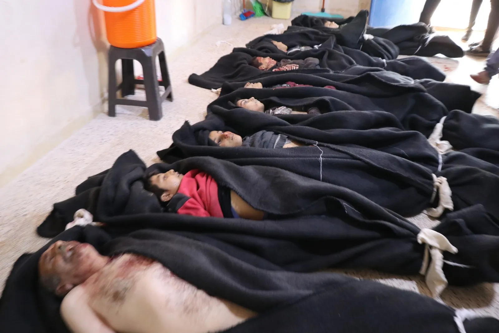 Wounded children in Tel-Rifaat massacre: We were playing suddenly we bombed