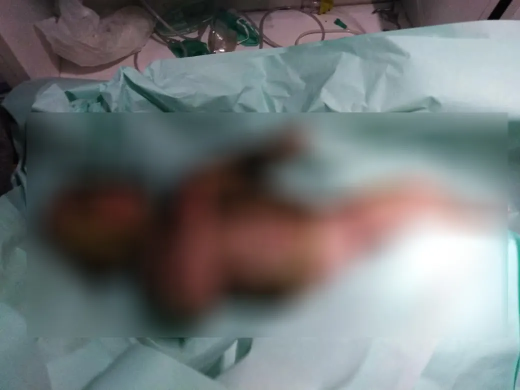 Turkkish woman, her child wounded by set fire in al-Hol camp