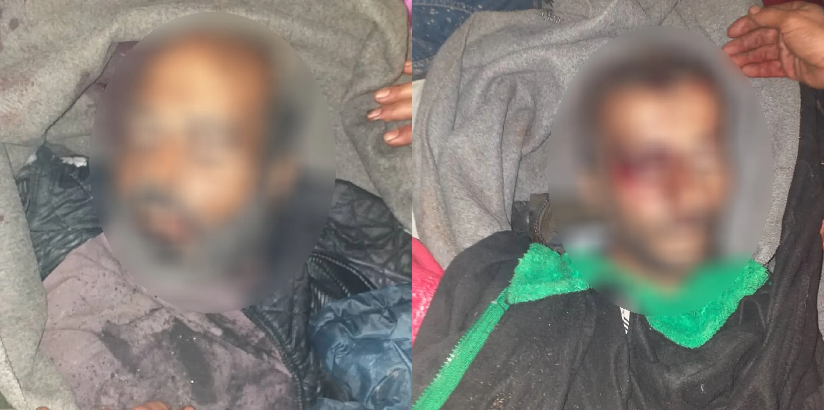 2 Afrin citizens lost life in mine blast