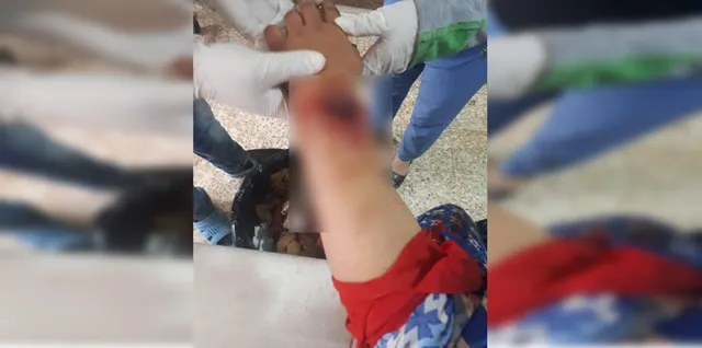 Civilians injured in shelling in Girê Spî countryside last night