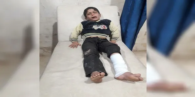 Child wounded after targeting Shiekh Eis village