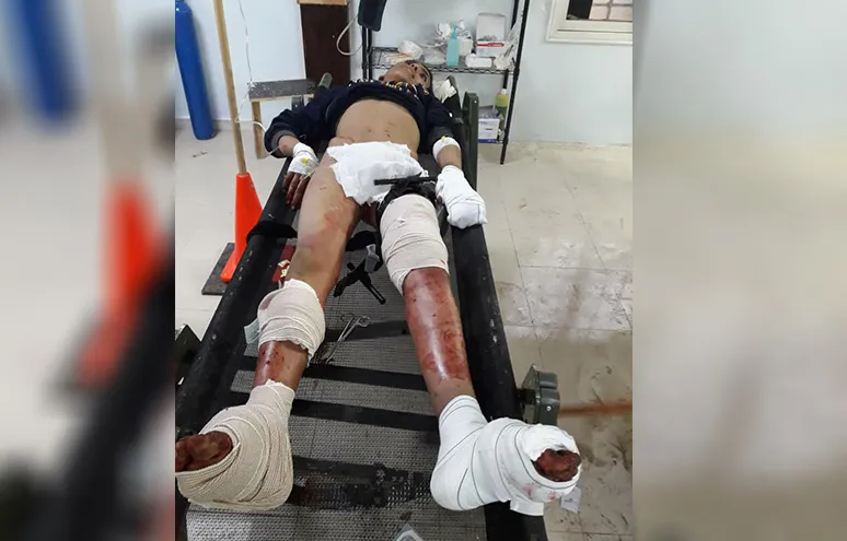 Child martyred, two injured in mine explosion in Girê Spî _ UPDATED