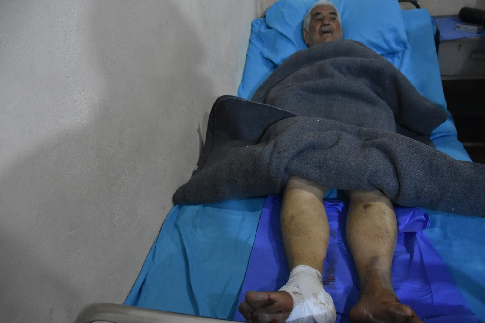 Elderly man injured in Turkish occupation of um al-Housh village-updated