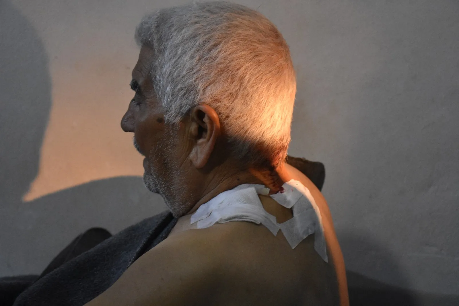 Elderly man injured in Turkish occupation of um al-Housh village-updated