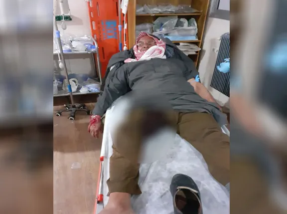  Number of wounded in Sukkaria rises