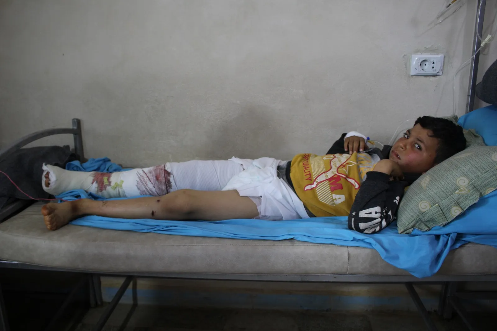 Two civilians wounded in an ISIS mine explosion in Al-Shahba