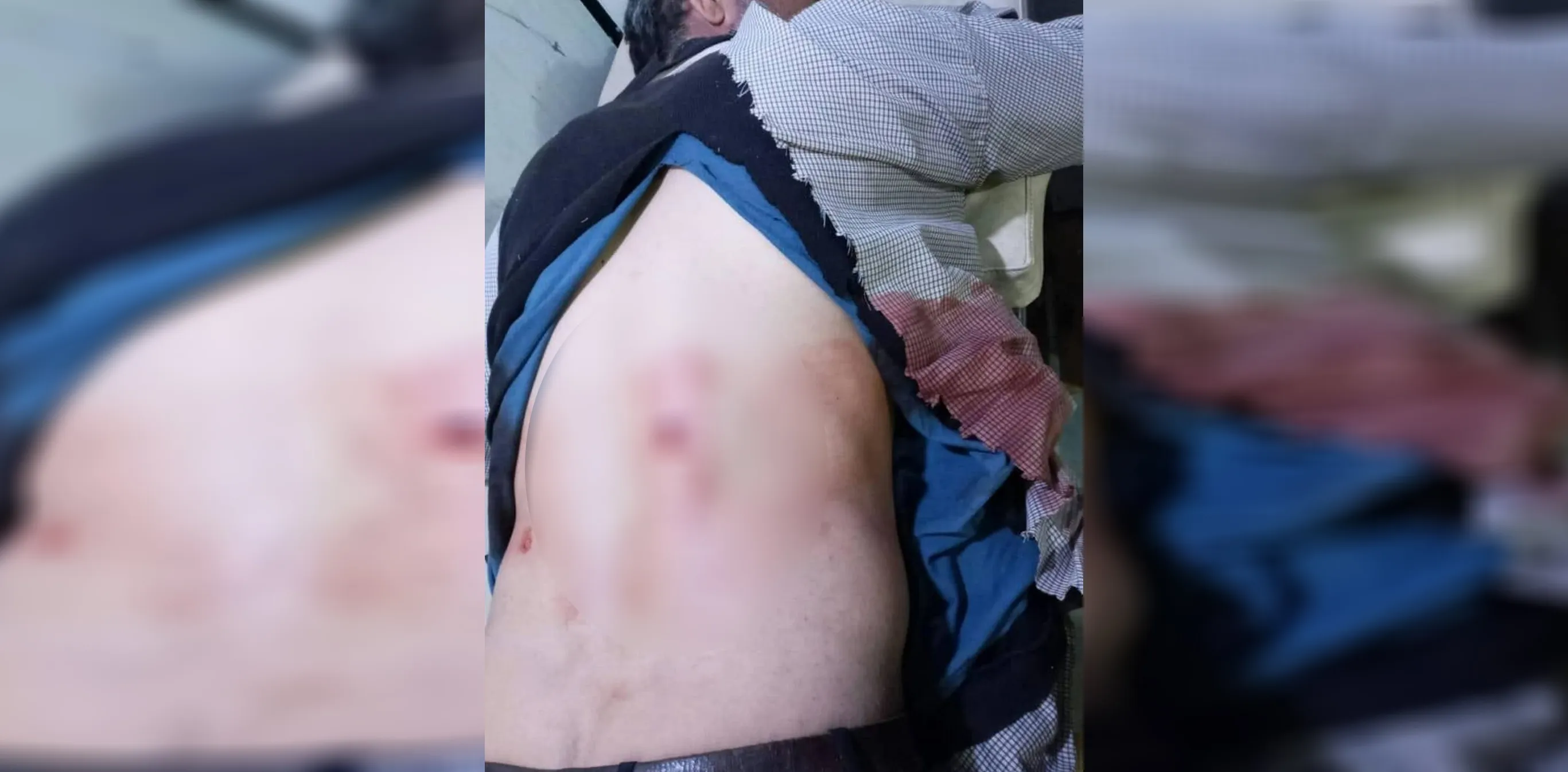 ​​​​​​​Civilian injured in Turkish occupation shelling on Al-Shahba canton