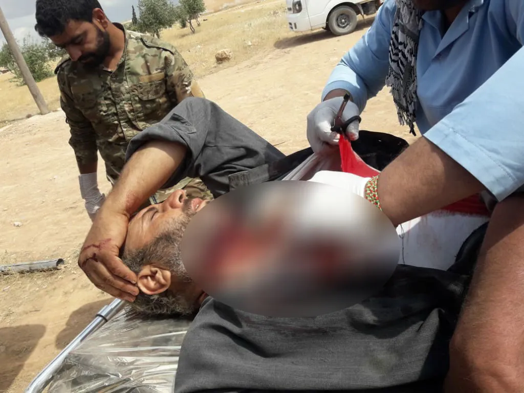 A shepherd was wounded after being targeted by the Turkish occupation