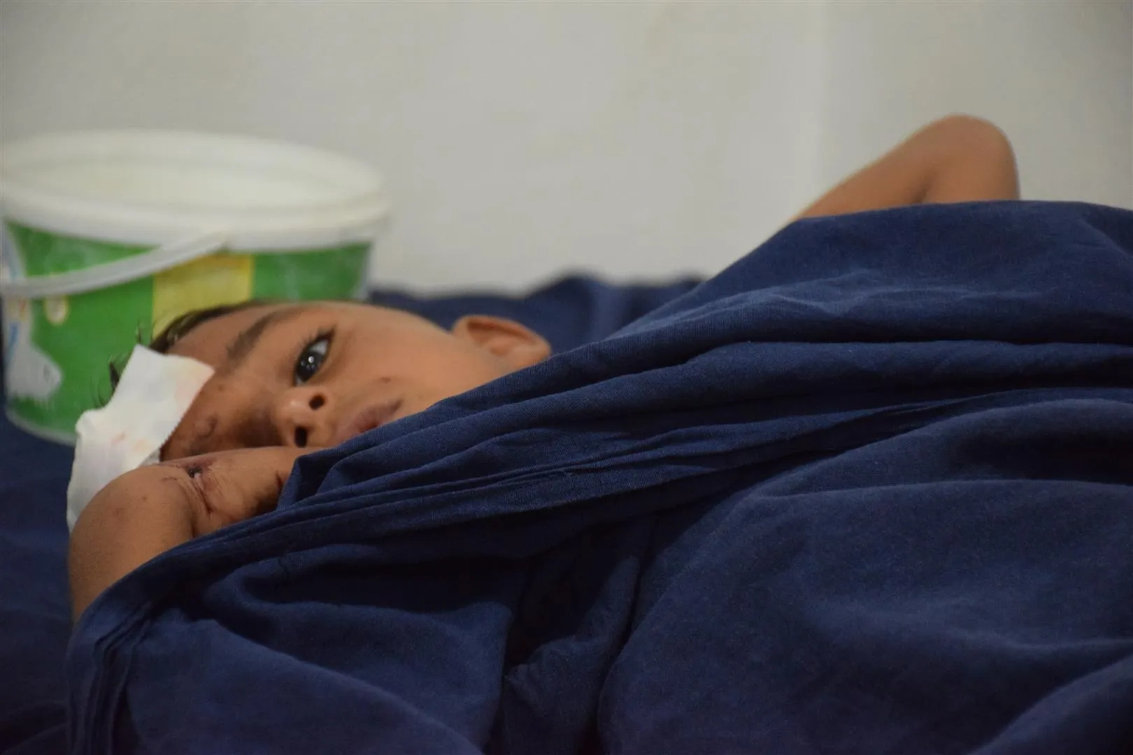 Al-Shadadi.. Four children wounded after unidentified persons threw a grenade at them