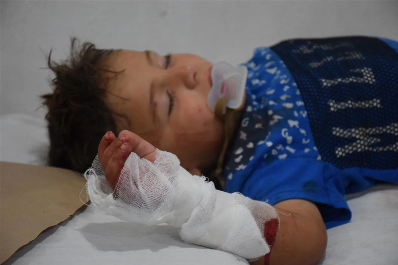 Al-Shadadi.. Four children wounded after unidentified persons threw a grenade at them