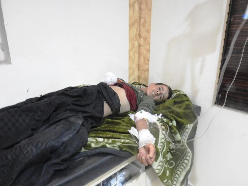 Citizen wounded due to mine explosion in al-Baghouz town