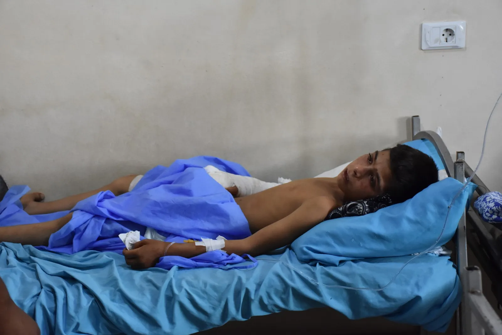 2 children injured by explosion ISIS landmine