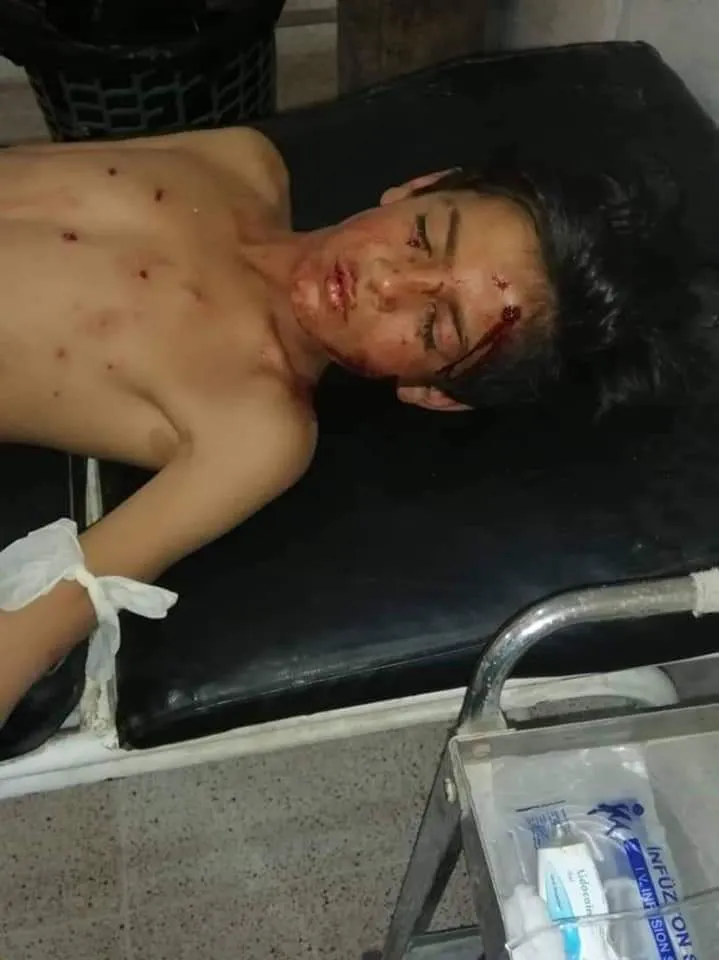 ​​​​​​​2 children injured in mine explosion in Deir ez-Zor eastern countryside