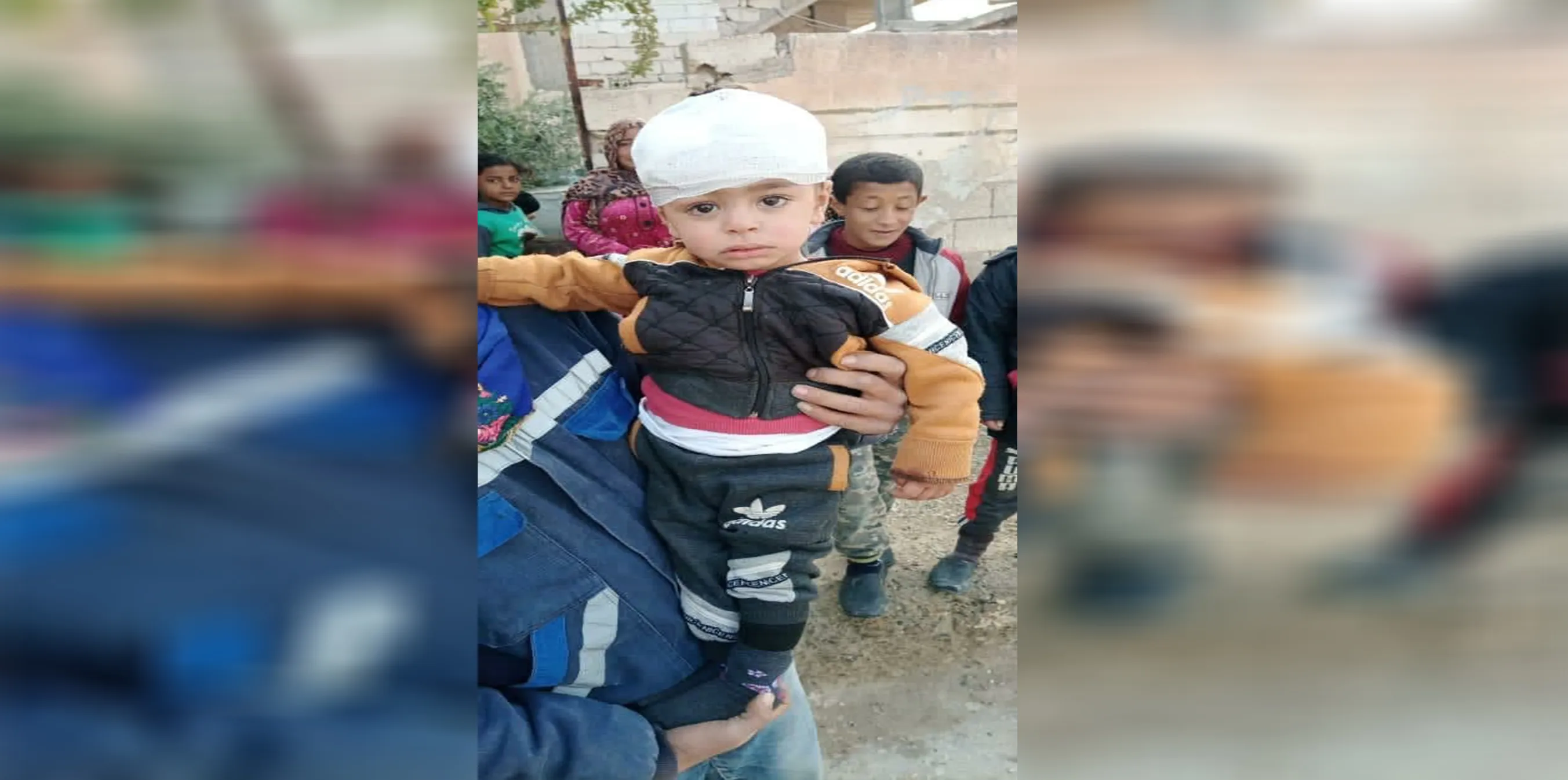 Two children injured by Turkish bombardment