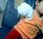 Child amputated in Suse of Deir Ezzor