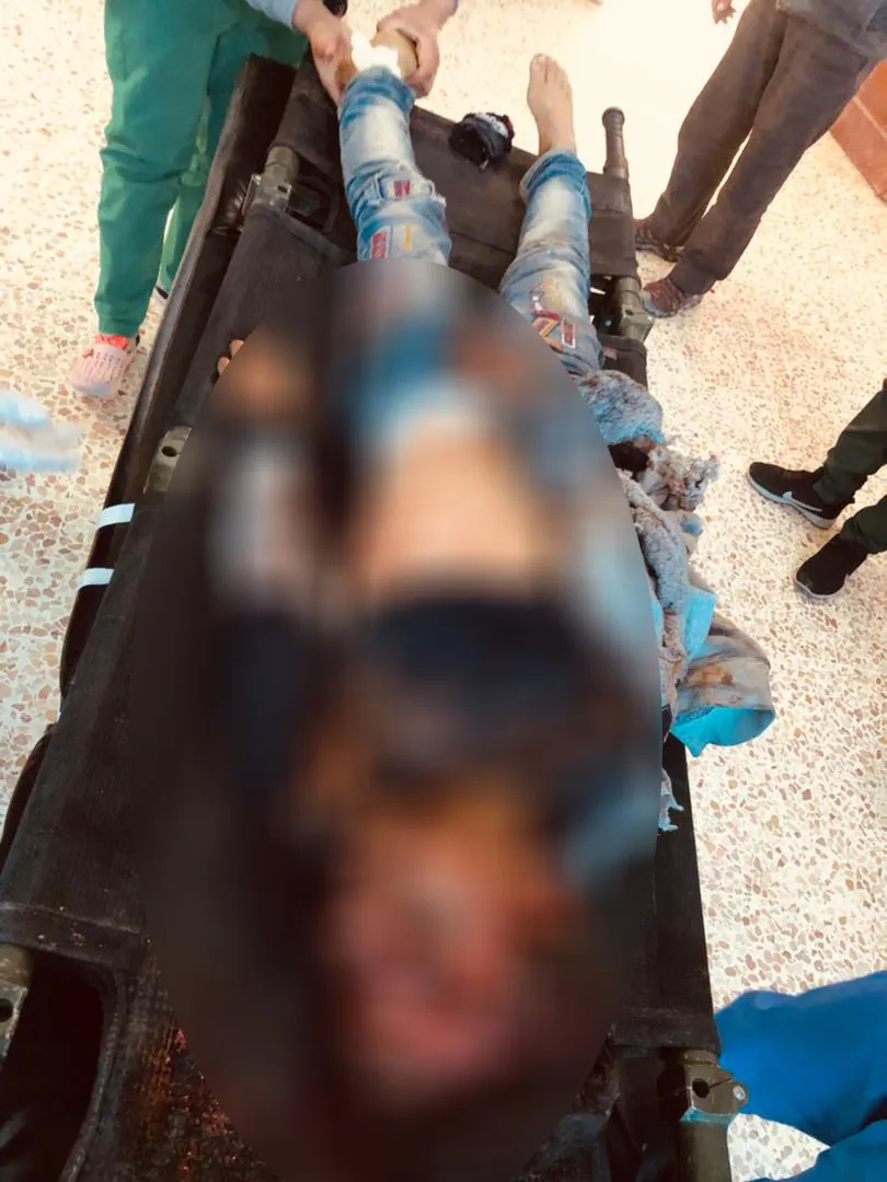 Turkish occupation's shell kills a child from Ain Issa